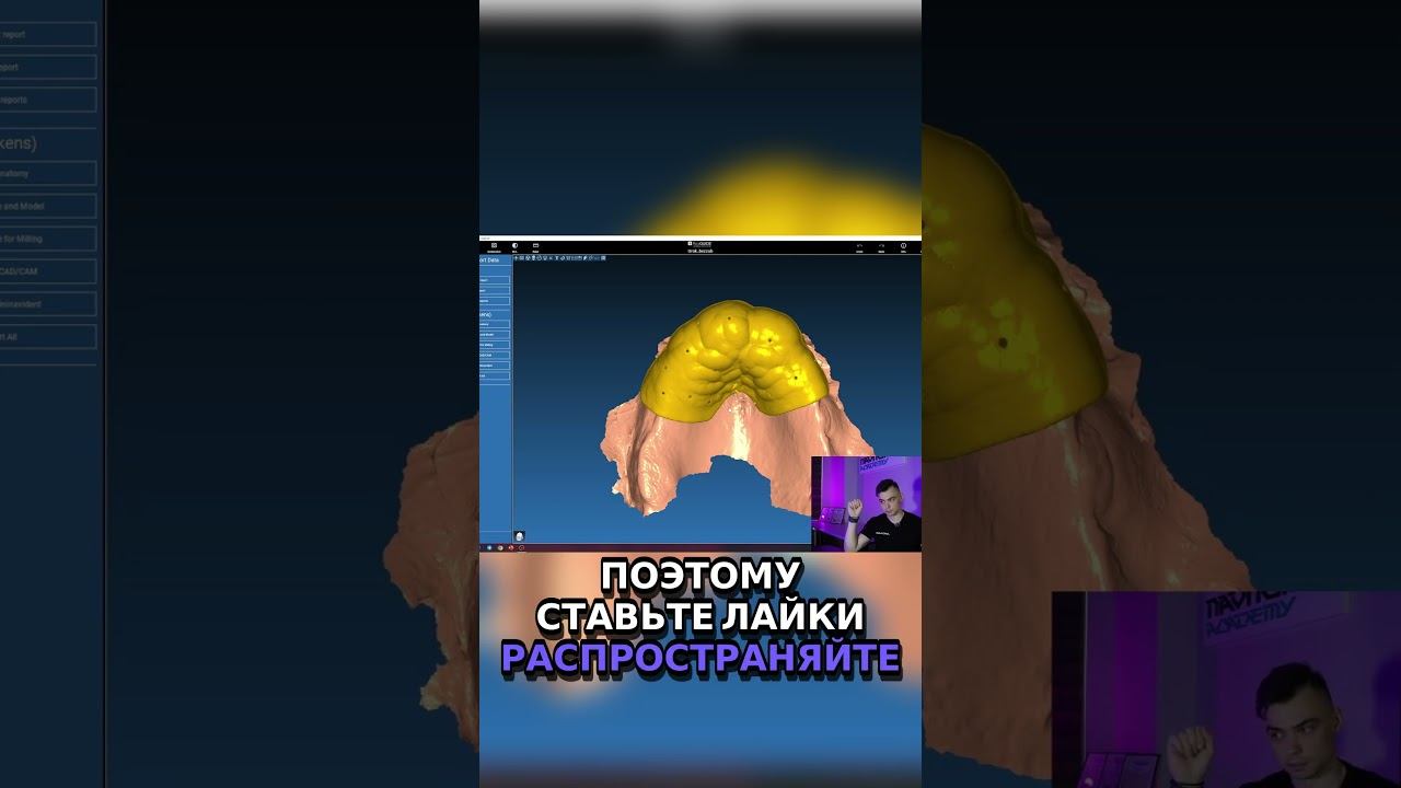 Как сопоставить хирургический шаблон  Узнайте прямо сейчас!