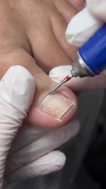 D6f5a18143207a44c1bc92d85af5464b