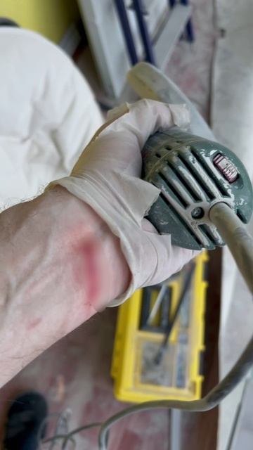 Миллиметр от смерти.