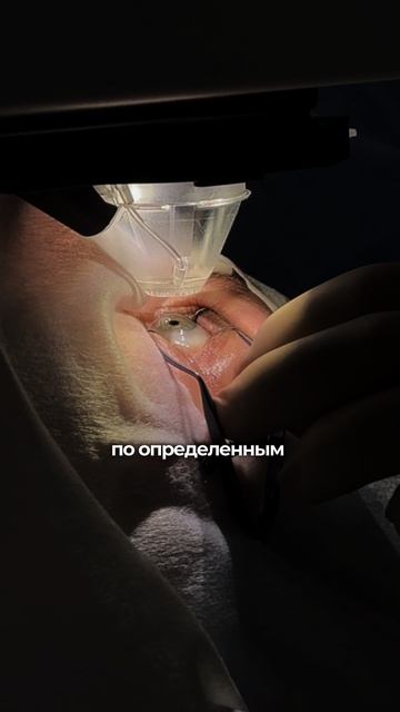 Космические технологии стыковки лазера к вашему глазу!