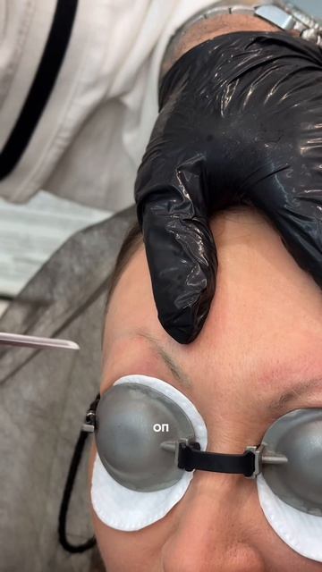 Удаление тату краски на бровях. Читай описание 👇