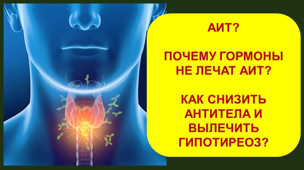 АИТ? Как вылечить АИТ и гипотиреоз без гормонов?