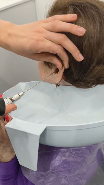 Серная пробка — это не «запущенные уши».