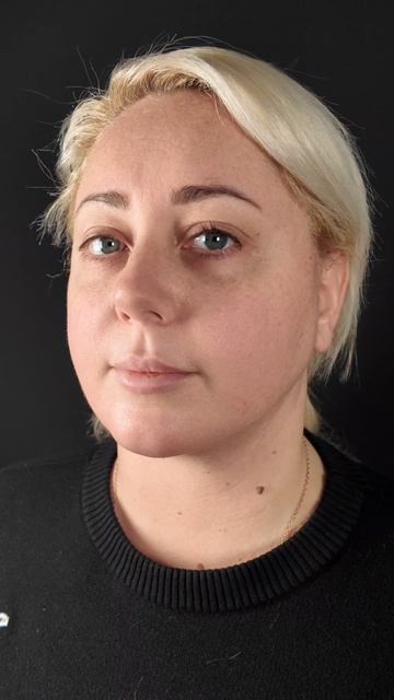 #deepplanefacelift #deepnecklift