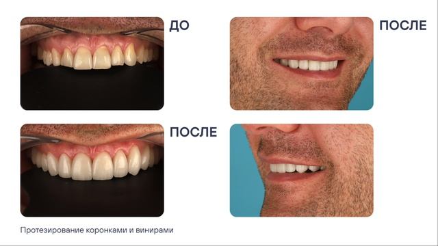 Клинков Данил Сергеевич, заведующий ортопедическим в MIR Dental Clinic By Dr. V. Pantsulaya