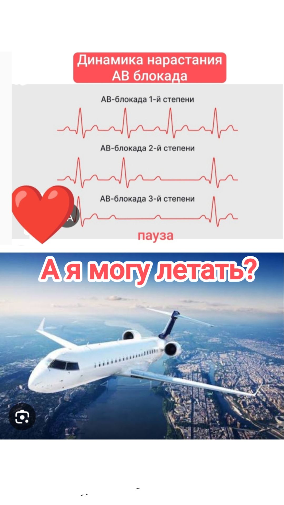 Что такое АВ блокада и можно ли заниматься спортом?