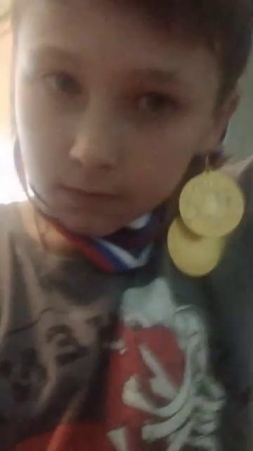 обзор на медали