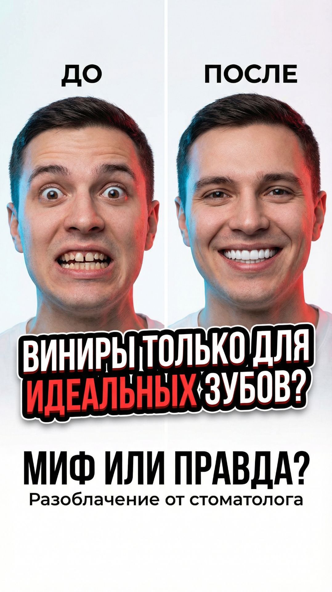 Виниры только для идеальных зубов  #стоматологиядоминанта #мифымедицины #виниры  #зубы