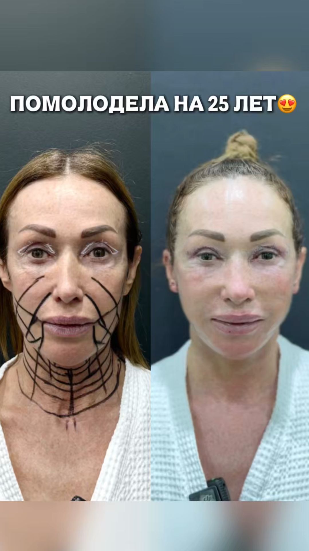 Почему мы всегда тянем до последнего? ❤️🩹