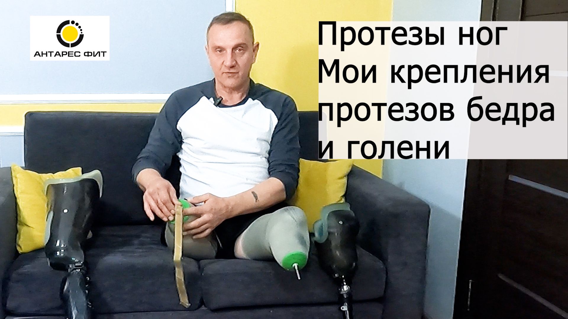 Протезы ног: Мои крепления протезов бедра и голени