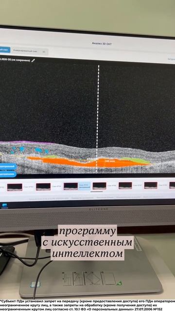 Искусственный интеллект в офтальмологии