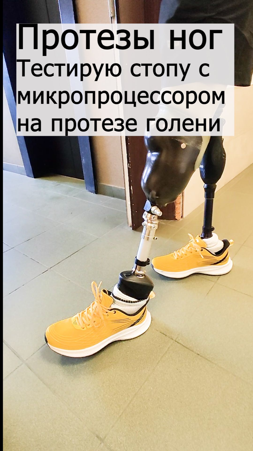 Протезы ног: тестирую стопу с микропроцессором на протезе голени