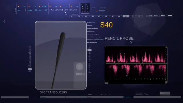 SonoScape S40Pro - УЗИ аппарат высокого класса  uzimir.ru