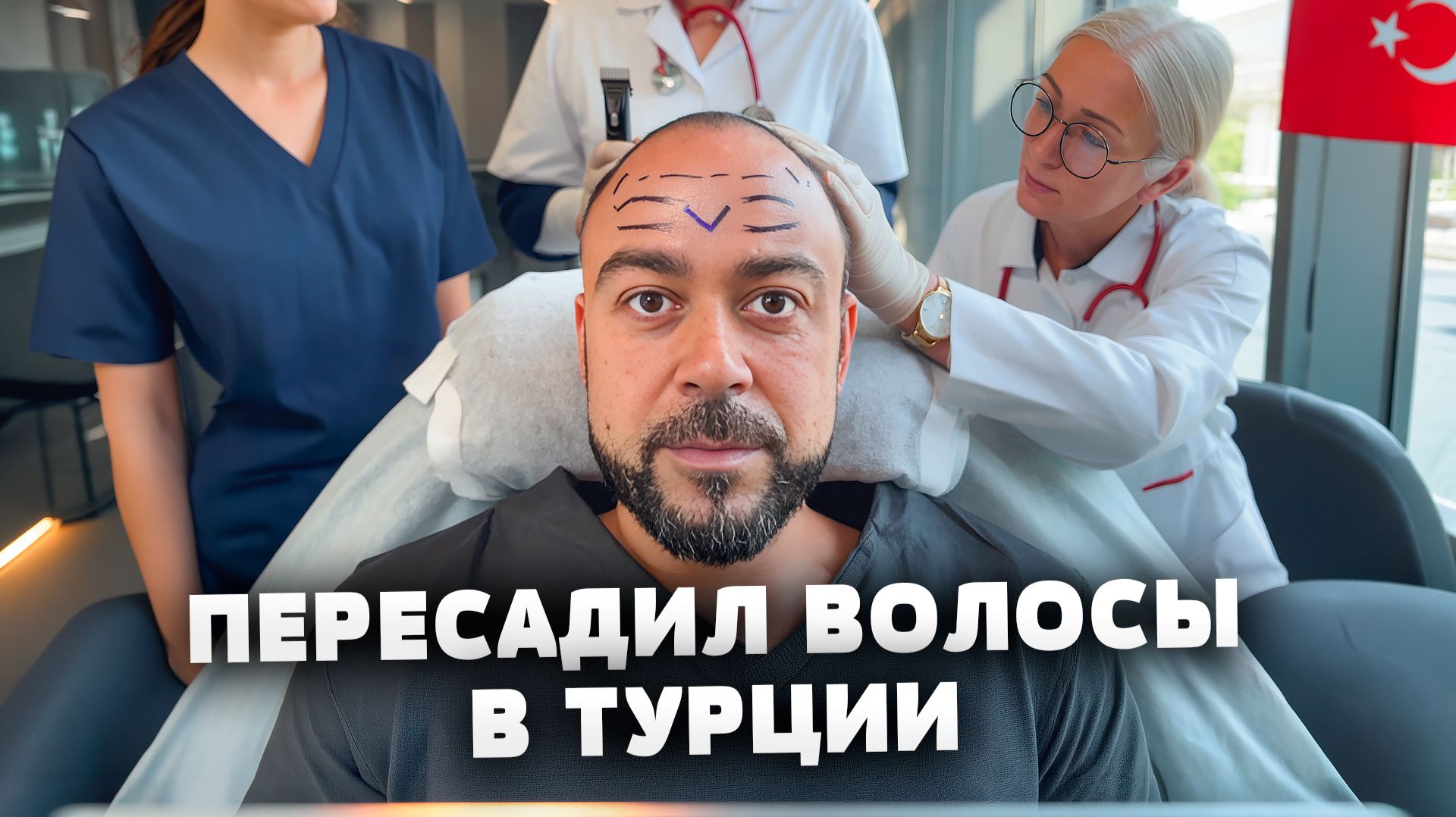 НЕ ОЖИДАЛ ТАКОГО! Стоит ли делать пересадку волос в Турции? Вы должны знать правду. Клиника Estemark