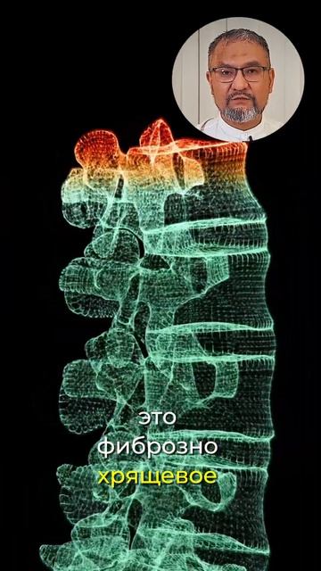 Что помогает грыже рассасываться? Ответ удивит! #hijama #хиджама #баночныймассаж #оздоровление