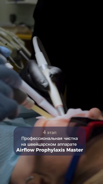 Профессиональная гигиена по протоколу GBT 🦷