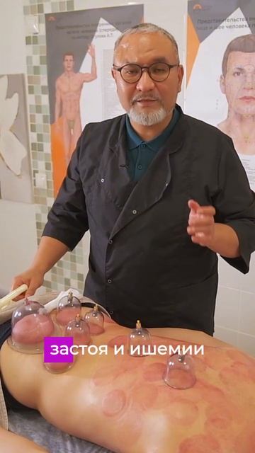 Что означают светлые и тёмные следы после баночного массажа? #hijama #хиджама #баночныймассаж