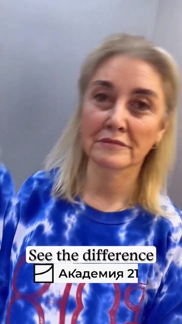 А вы знали, что можно подтянуть лицо без единого разреза?