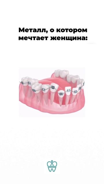 Исправление положения зубов  #стоматологиядоминанта #ортодонт #элайнеры #брекеты  #зубы #полезно