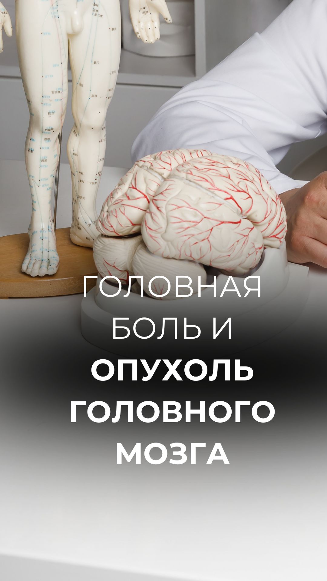 Особенности головной боли при опухоли головного мозга