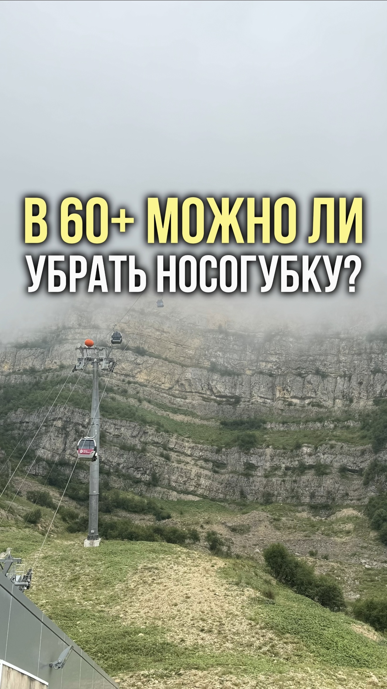 В 60+ можно ли убрать носогубку?