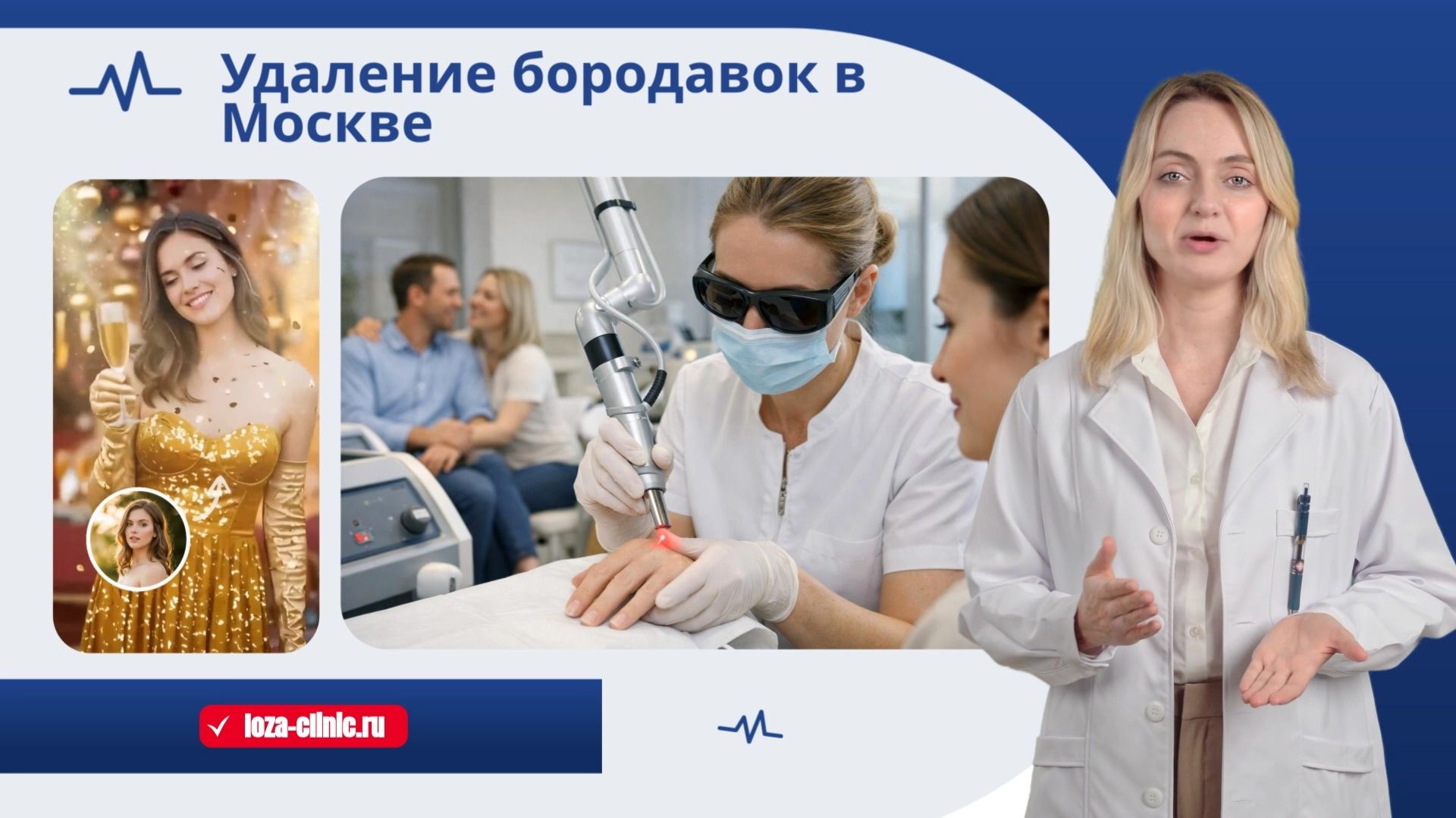 Удаление бородавок лазером в Москве