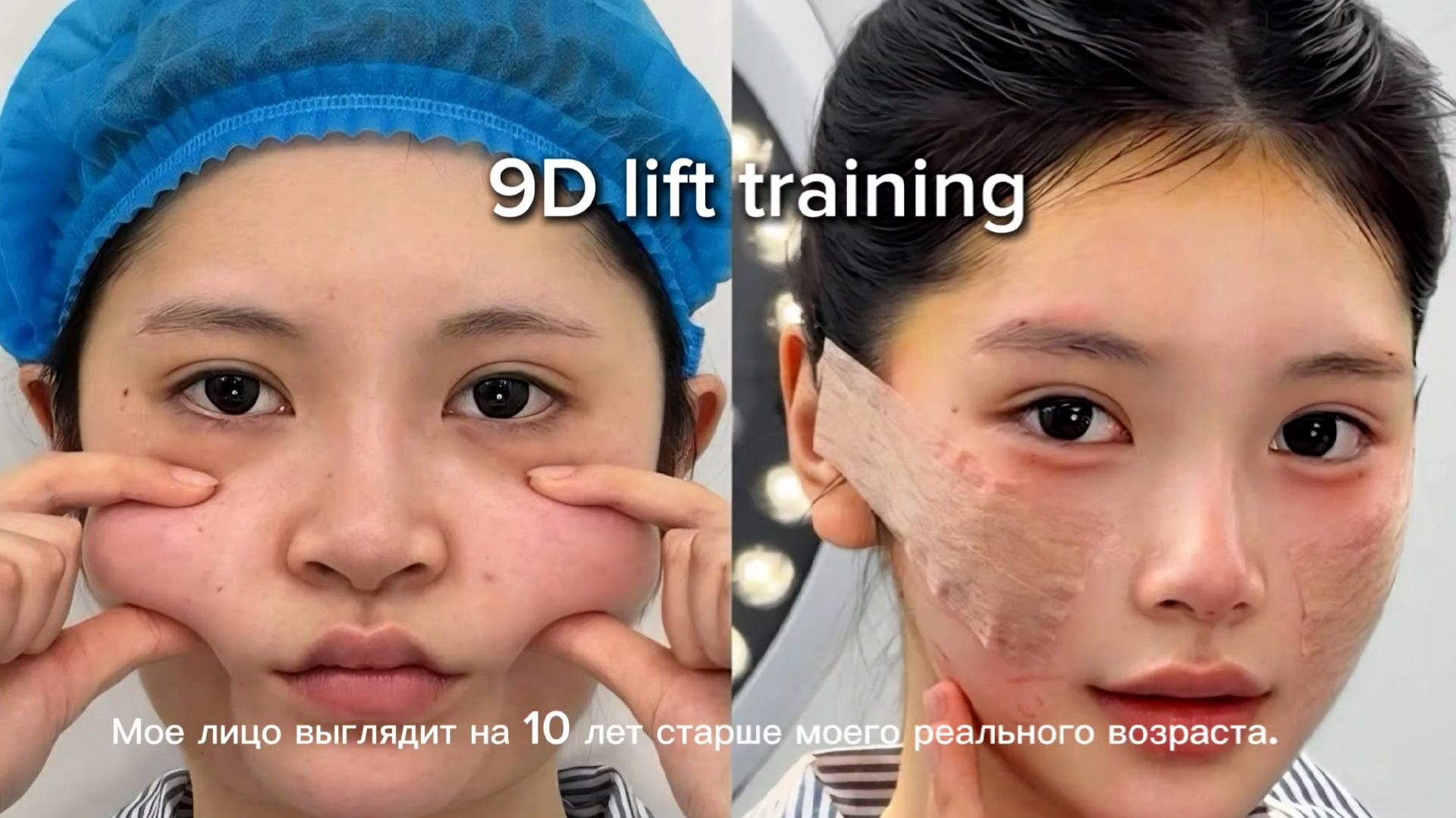 Обучение 9D Facelifting - Академия 21