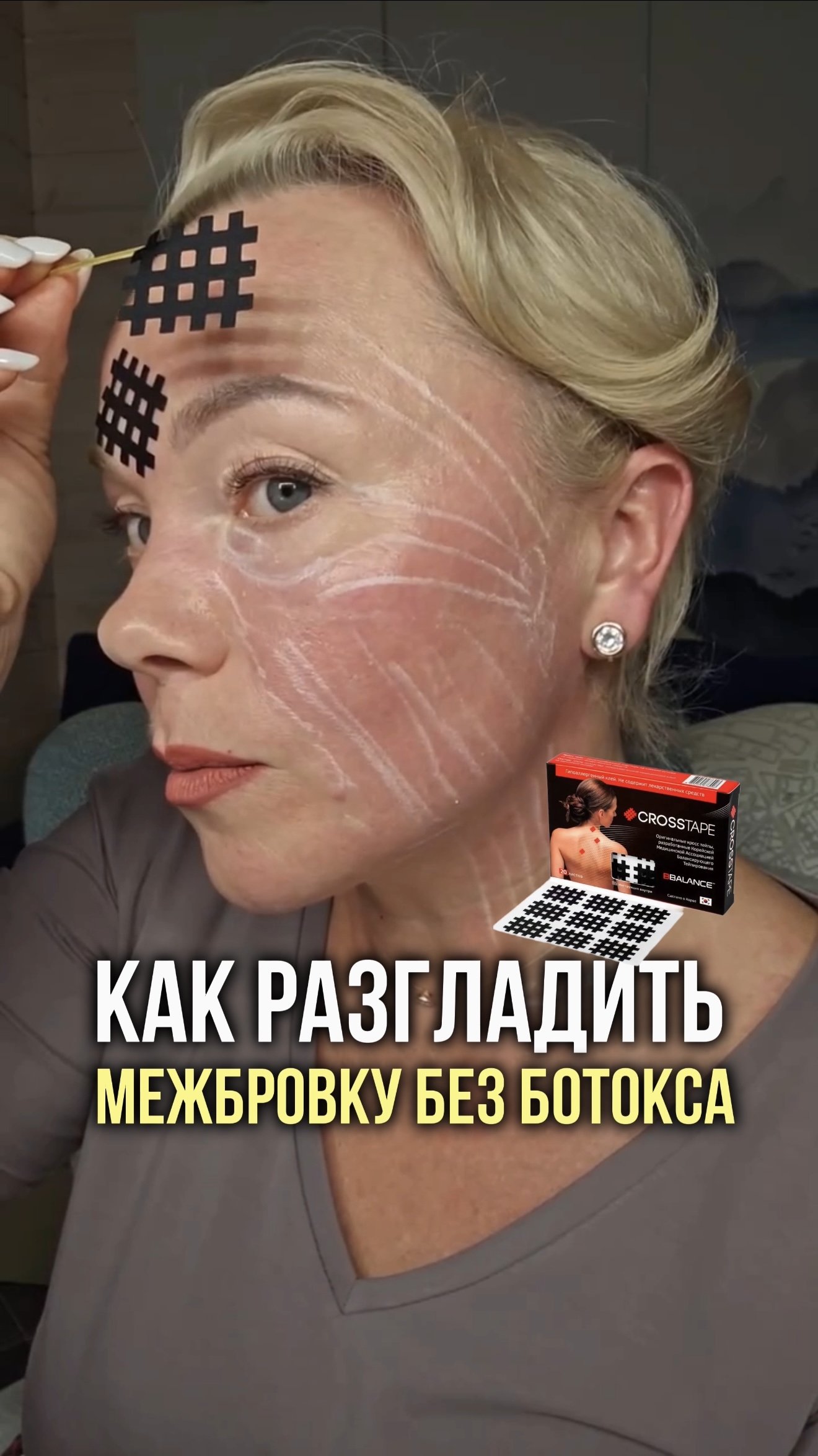 Как избавиться от межбровки без ботокса.