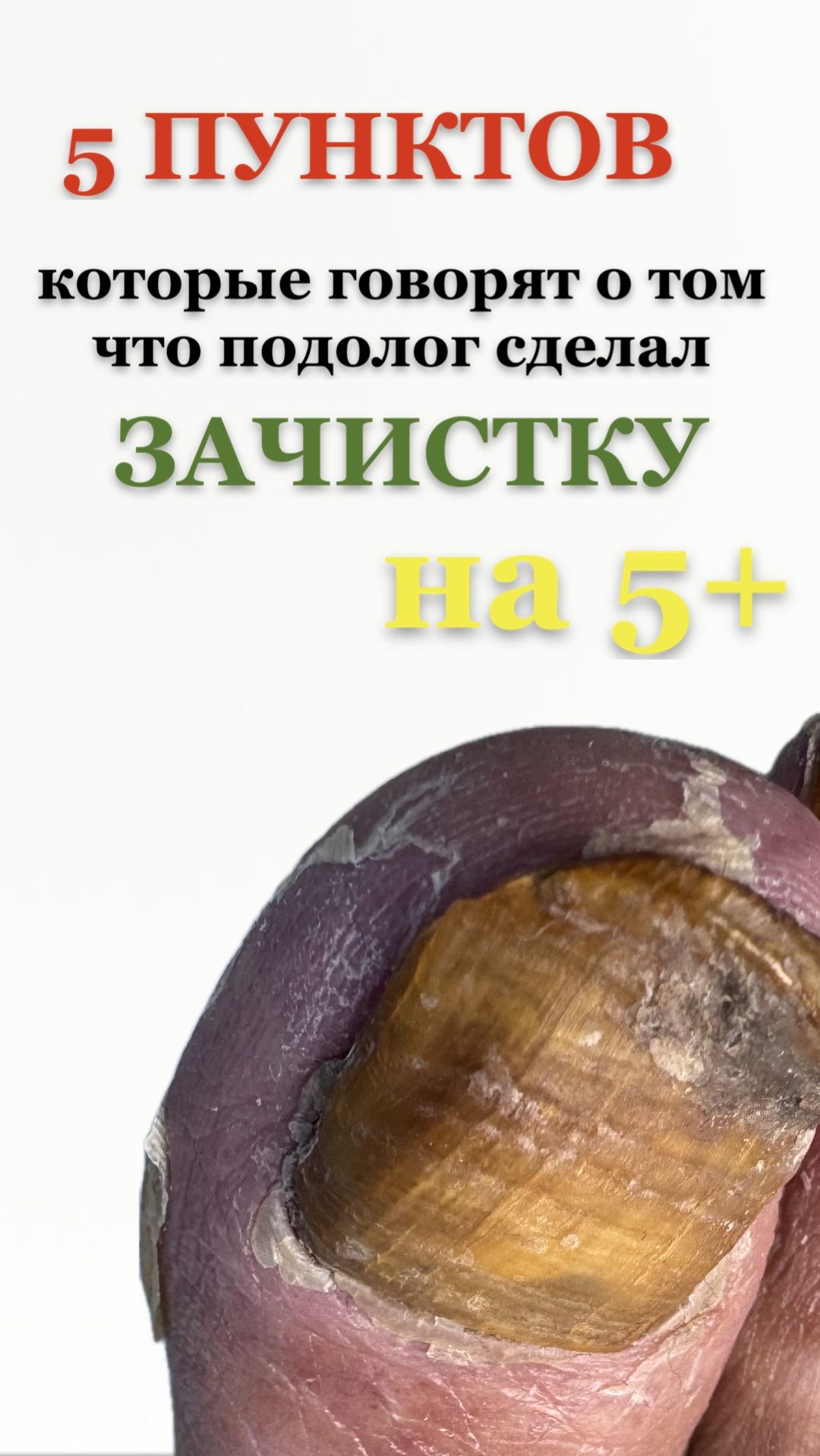 5 пунктов которые говорят о том что подолог сделал зачистку на 5+
