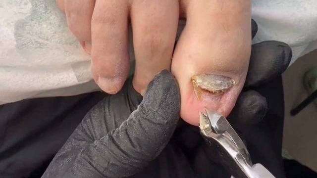 Мысли вслух или совет от подолога / подолог / совет