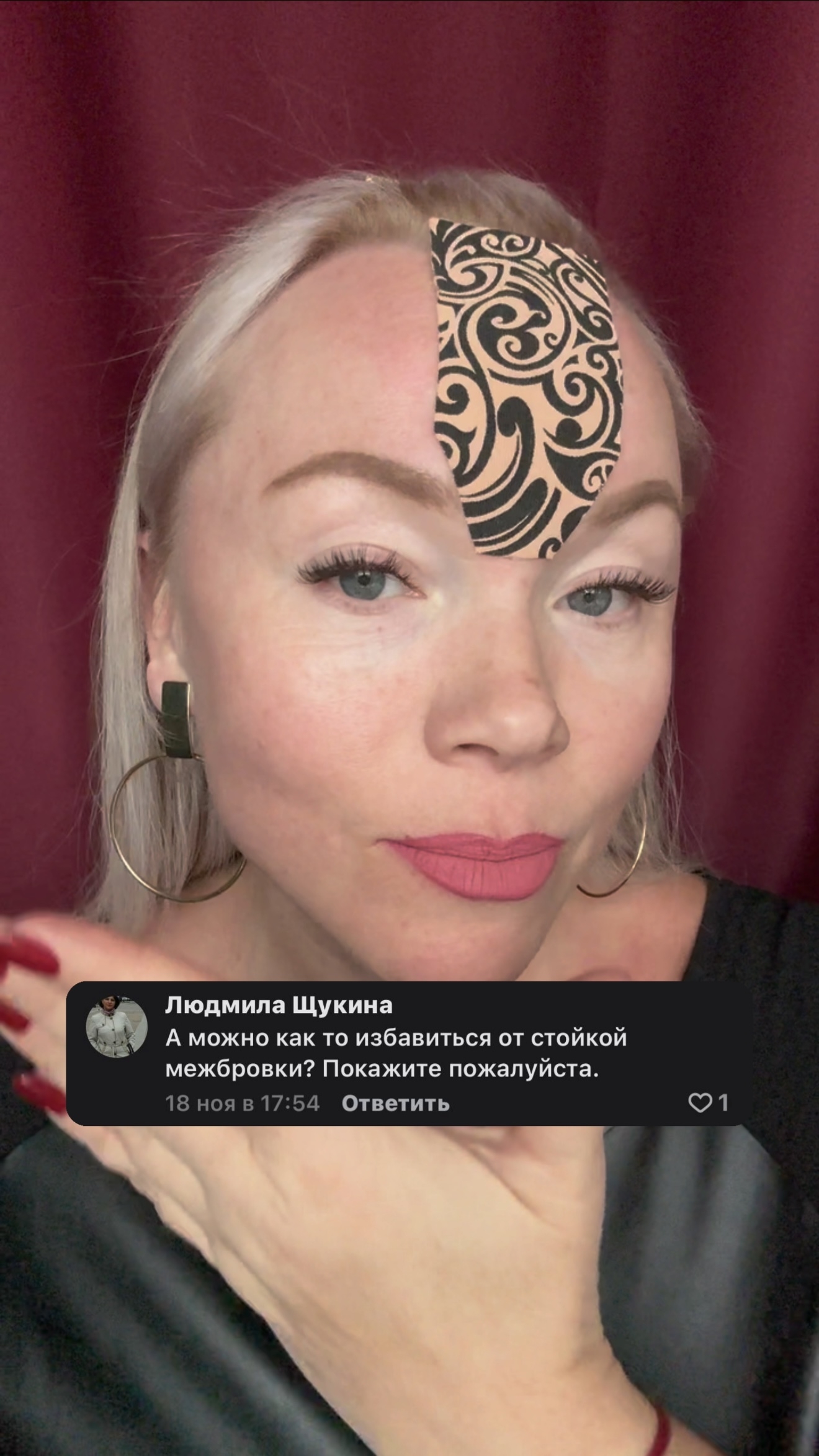 Как избавиться от стойкой межбровки?