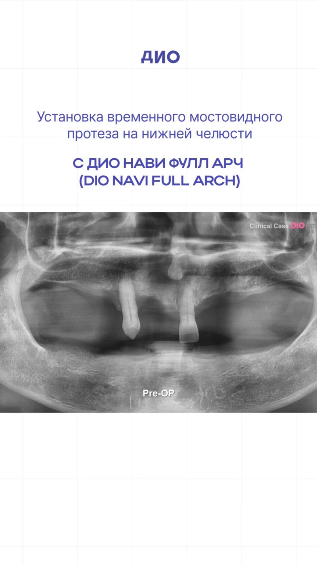 E5d9220b9d868beccb2112d59d2385a8