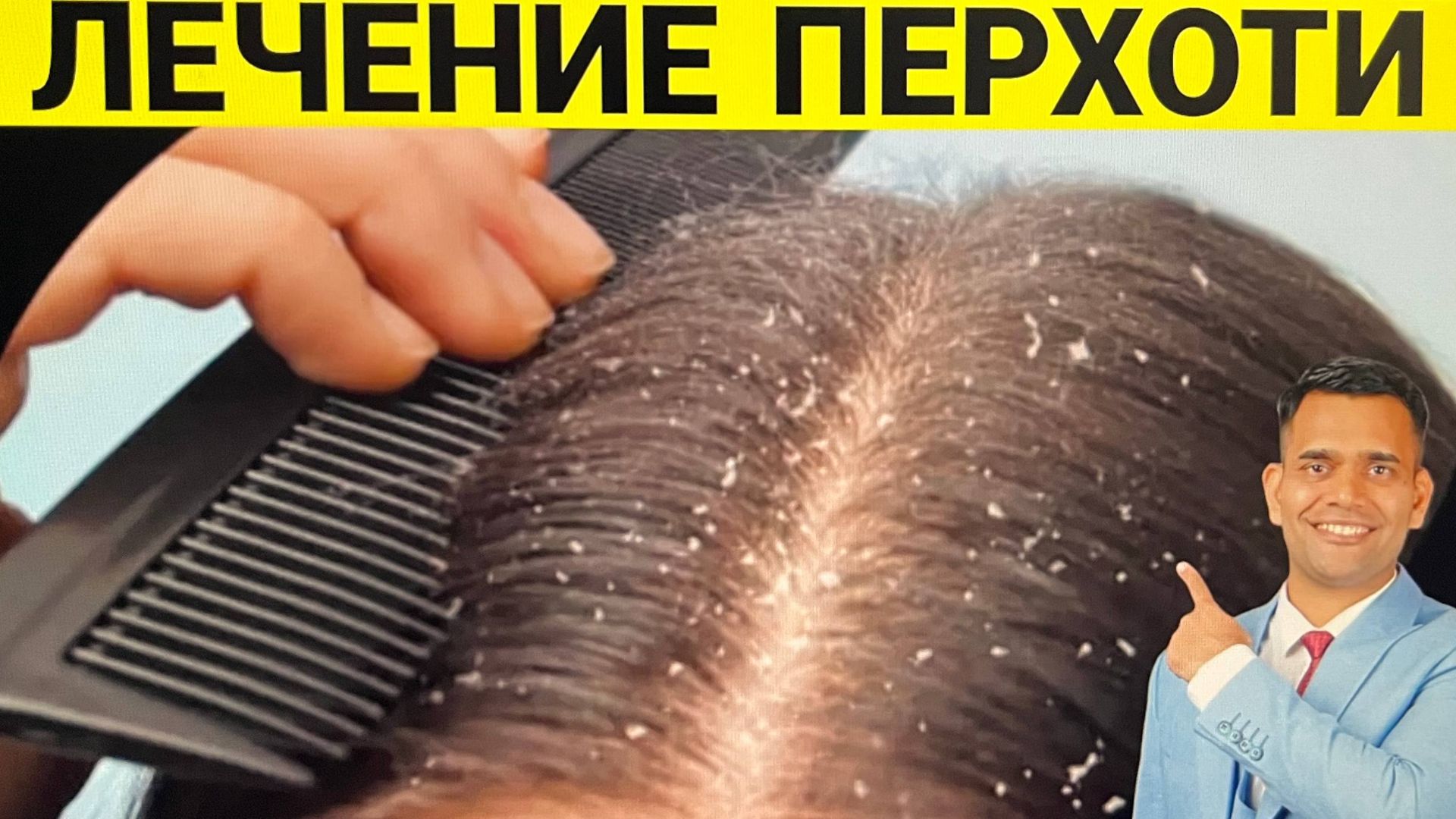 ВЫЛЕЧИТЬ ПЕРХОТЬ ОЧЕНЬ ЛЕГКО!