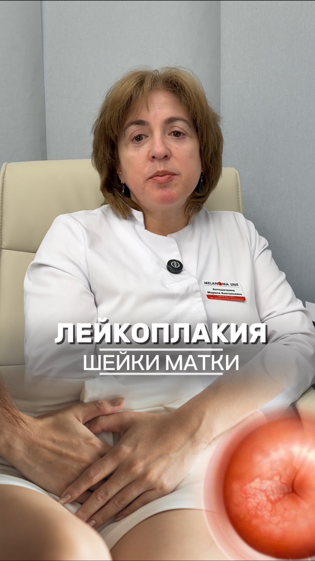 Лейкоплакия шейки матки / меланома юнит