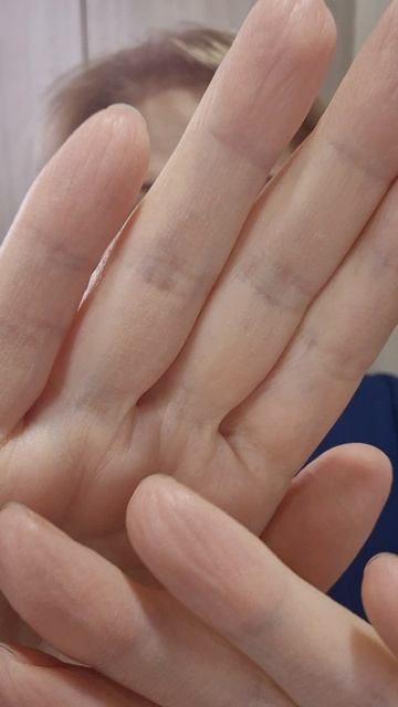 Очищает зрение энергией Рейки.