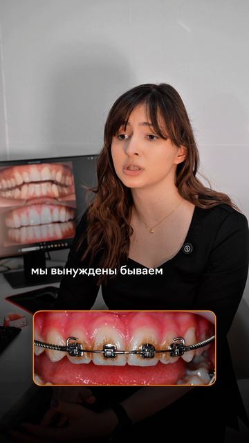 Пишите свои вопросы, наши врачи с удовольствием ответят на них! Еще 4 части ищите в нашем профиле.