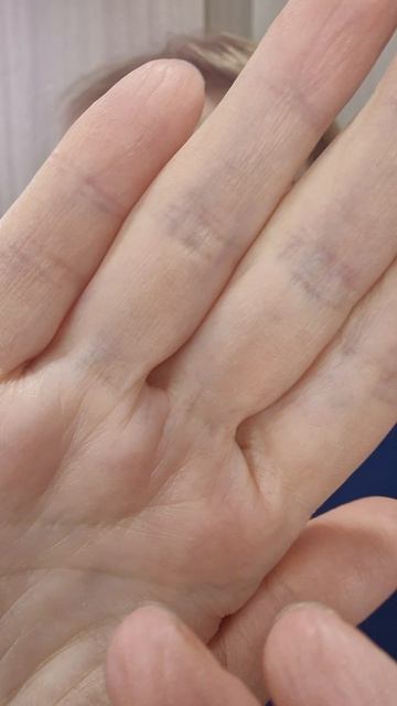 Мягкое исцеление ушей энергией Рейки.