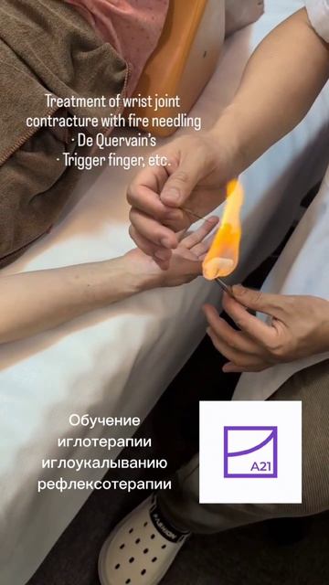 Огненное иглоукалывание запястья — болезнь де Кервена и палец-курок | Обучение Алматы