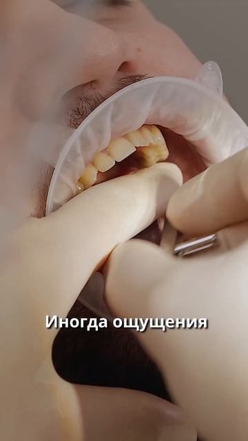 Какие ощущения во время имплантации