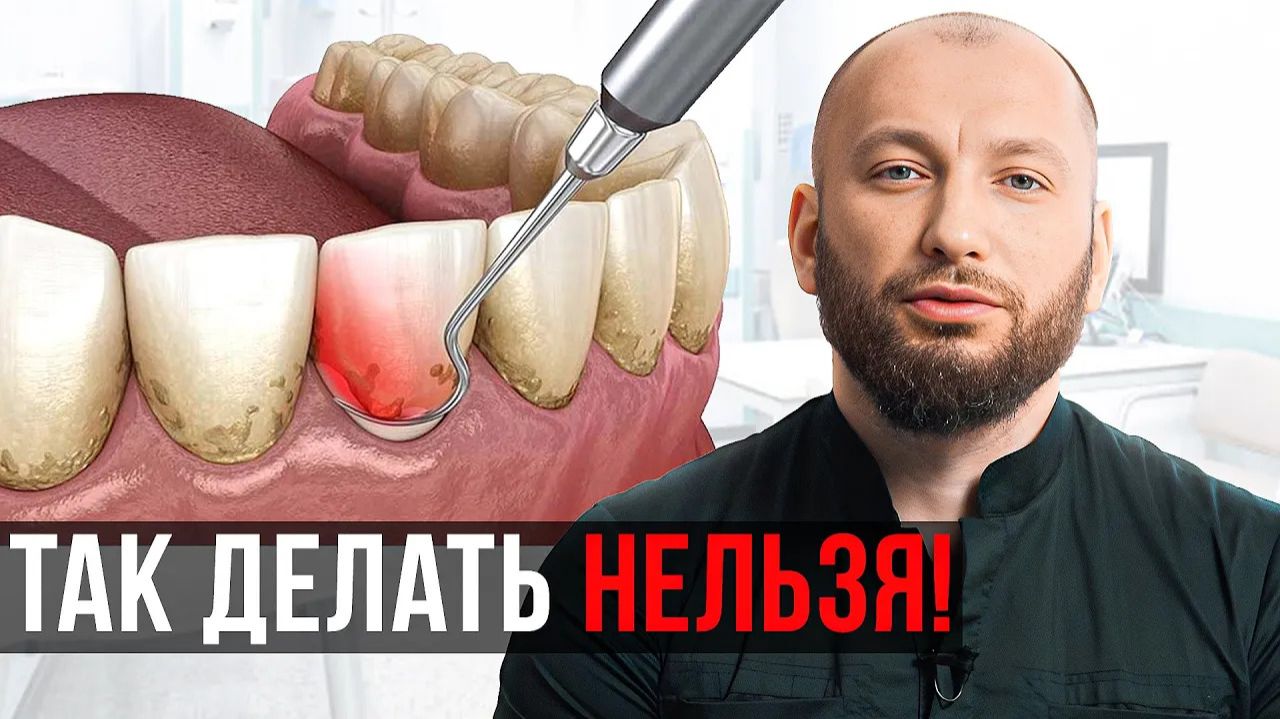 Зубной камень! Можно ли УБРАТЬ его в домашних условиях?
