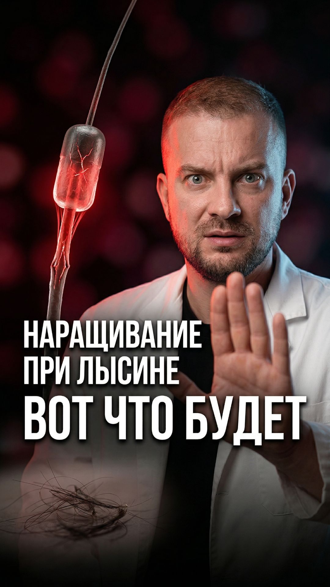 Наращивание при выпадении волос — почему это ускоряет облысение