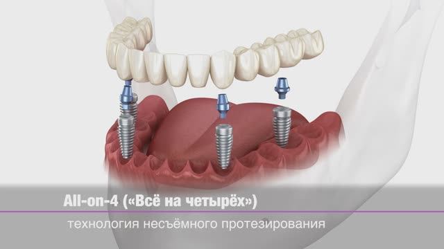 D1492c0e550809c92420324c8bd7fe0a