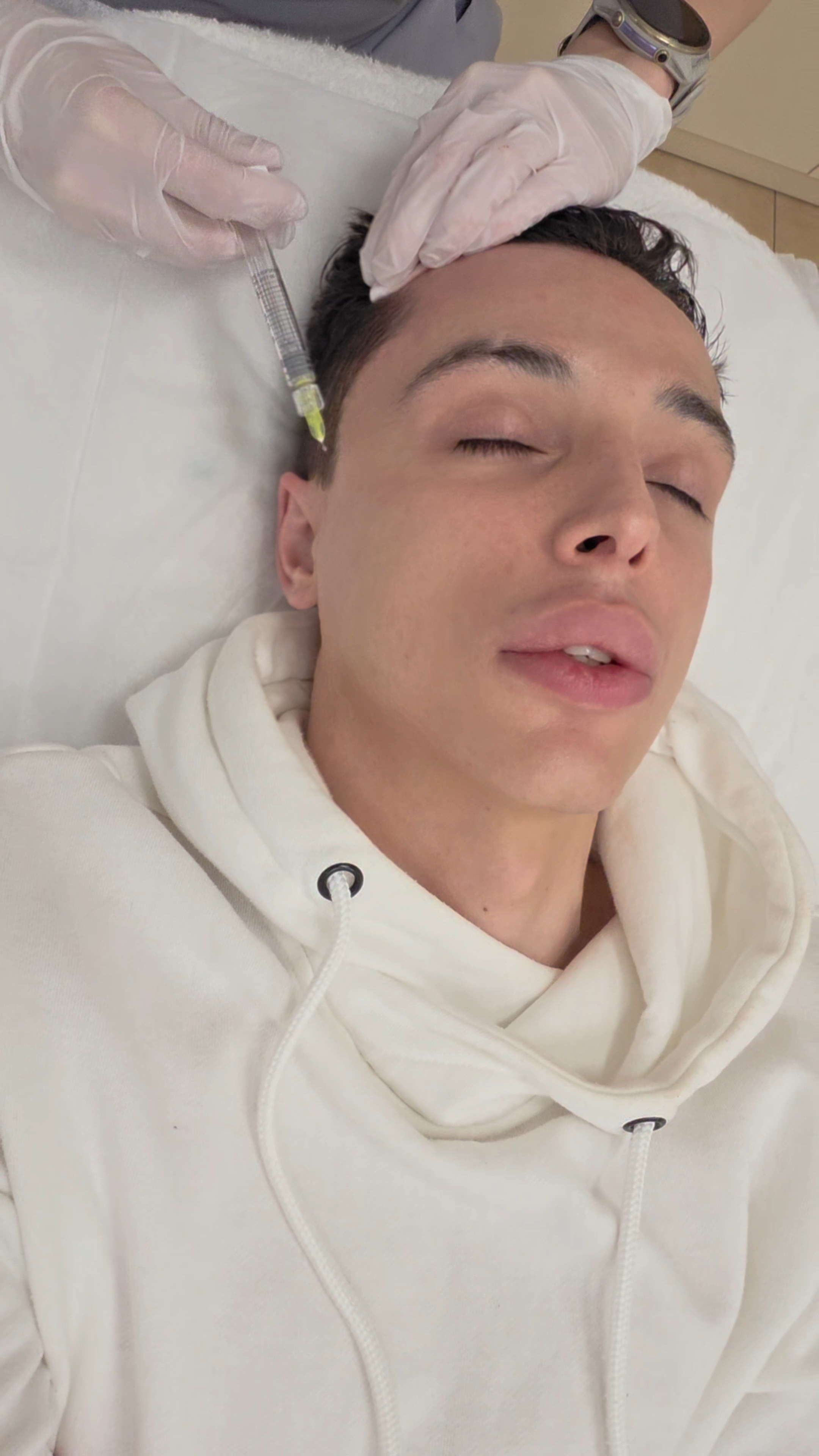 Пептидная мезотерапия волос #мезотерапия #волосы #уколыкрасоты #косметология #косметолог #здоровье