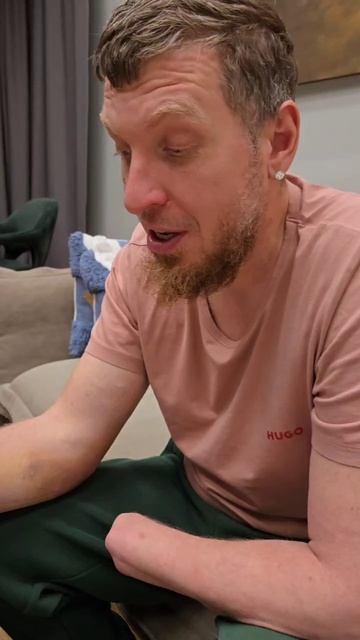 Потихоньку всё заживает #рука #перелом #здоровье