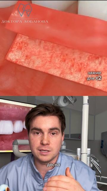 А Вы знали, что если у зуба приподнимается десна, то такой зуб может расшататься и выпасть