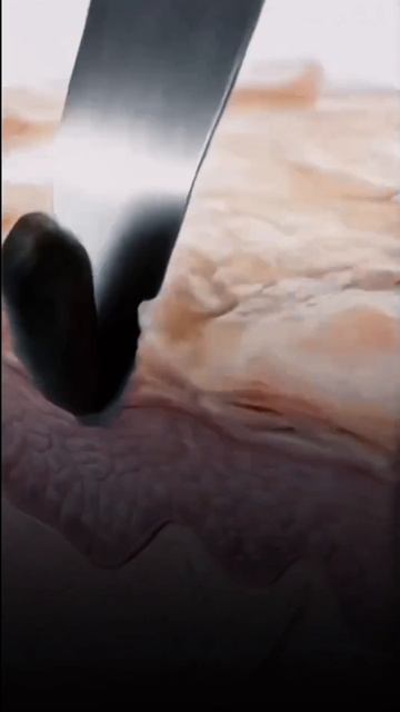 Зачем мне чистка, если у меня есть хороший домашний уход?