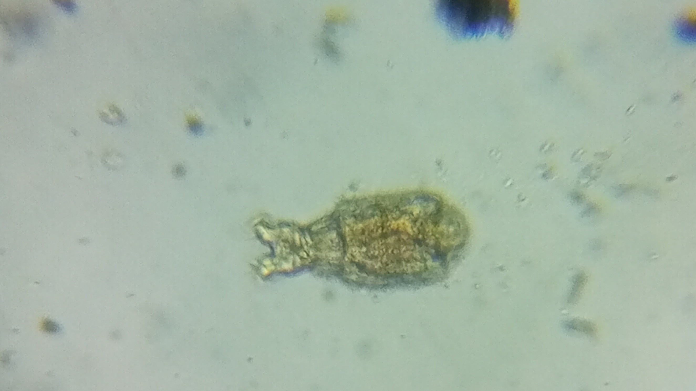 куча коловраток в одной капле со мхом