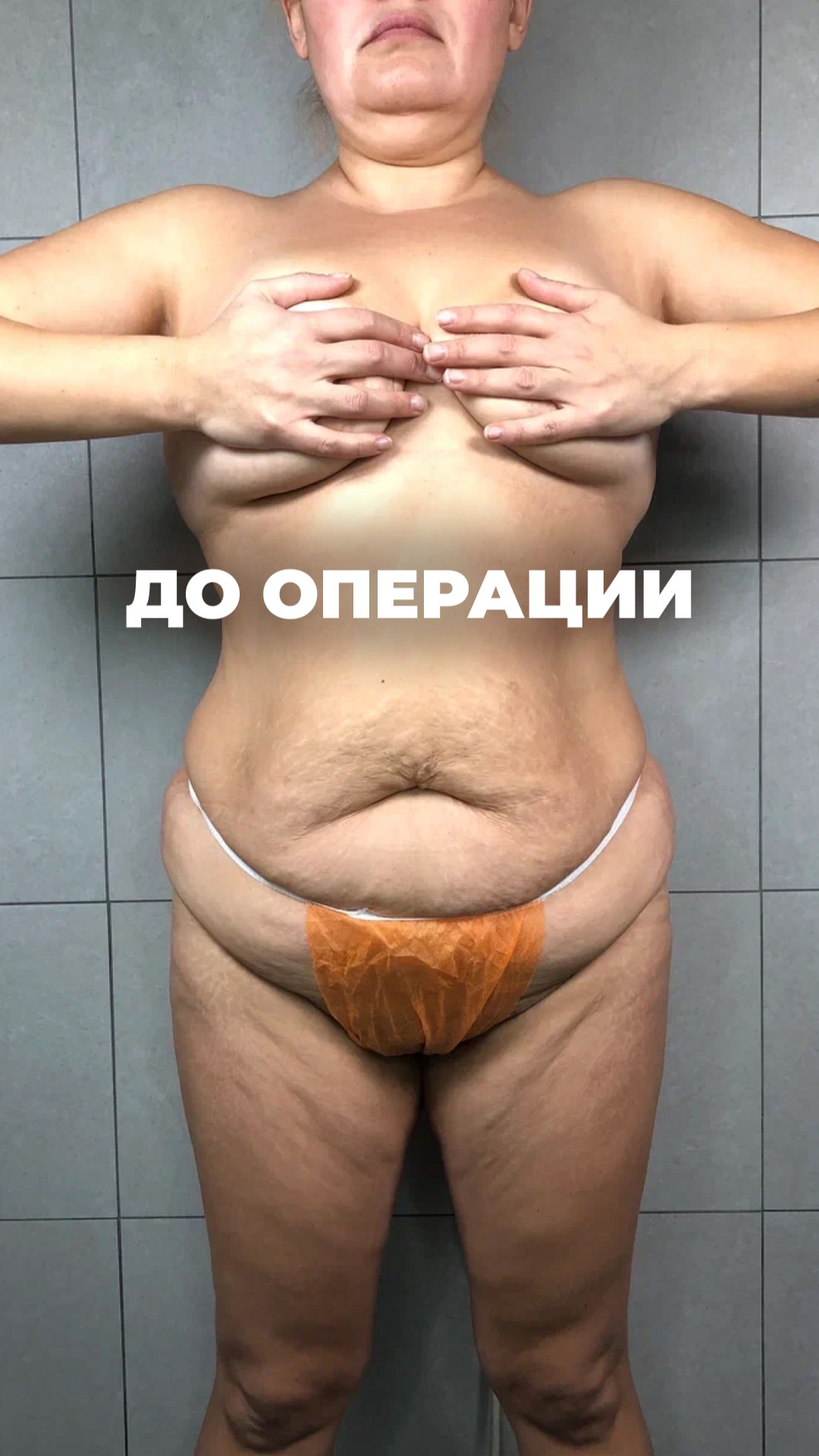 До операции