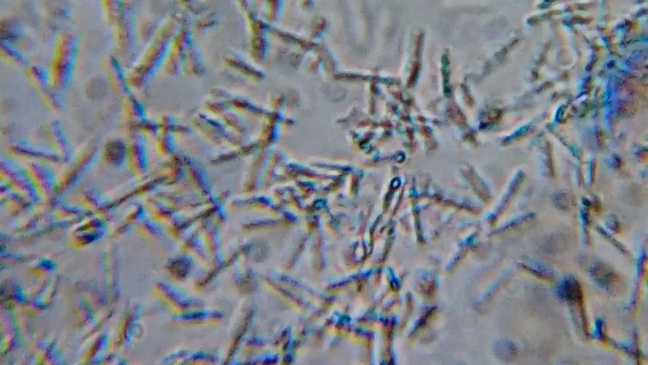 5 минут из жизни микроорганизмов подписывайся на мой Макс https://max.ru/u/f9LHodD0cOLuFuHadMfzlNRT2