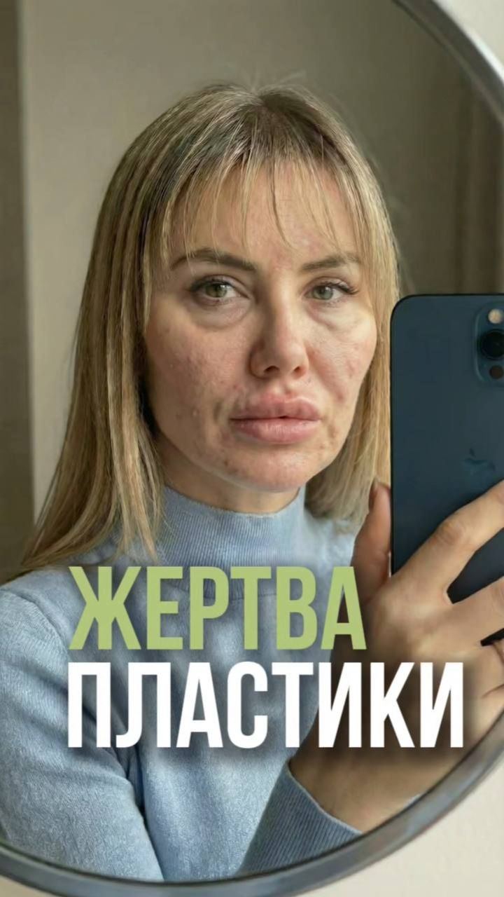 Как злоупотребление пластикой влияет на внешность!